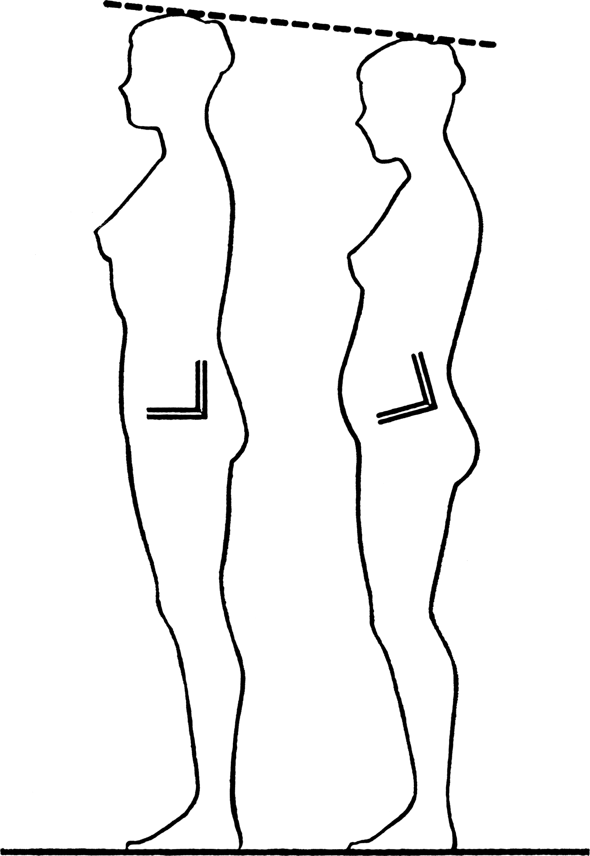 Posture illustration showing the pelvis and hip region